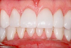 Maitland Avenue Dental | Dentures, Veneers and Implant Dentistry